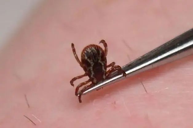 SP registra 18 mortes por febre maculosa em 19 casos confirmados