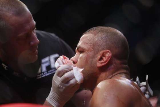 ufc