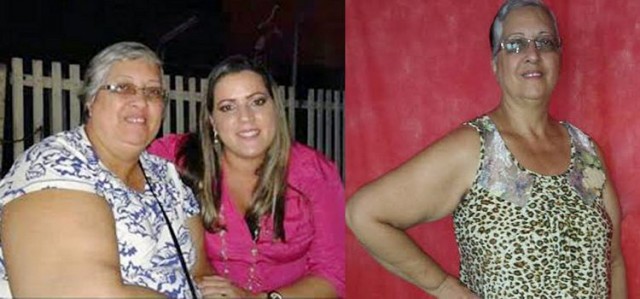 bariátrica