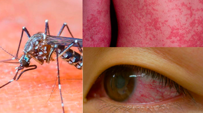 zika mosquito