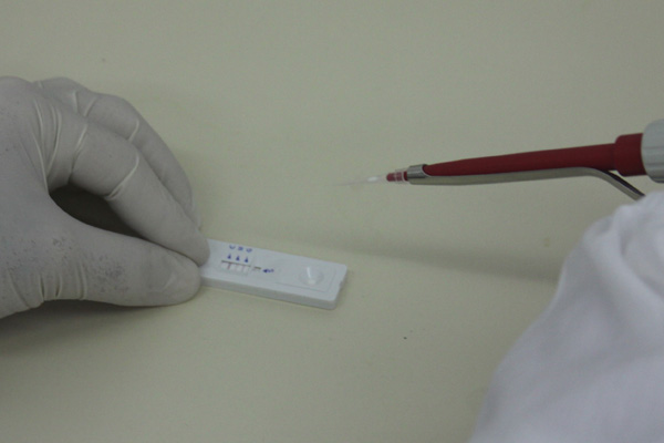 Teste-dengue-20min
