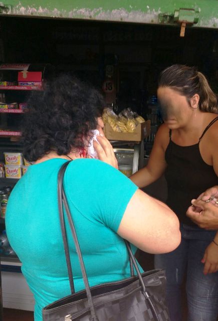 A vítima coloca um lenço no rosto durante o socorro