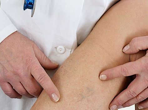 estabelece-tratamento-angiologista-Carlos-Peixoto_ACRIMA20160319_0015_15