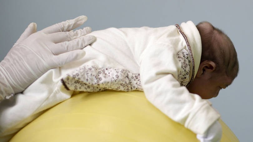 size_810_16_9_bebe-com-microcefalia-causada-pelo-zika-virus-fazendo-exercicios-com-acompanhamento-medico
