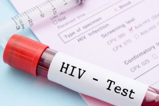 hiv teste