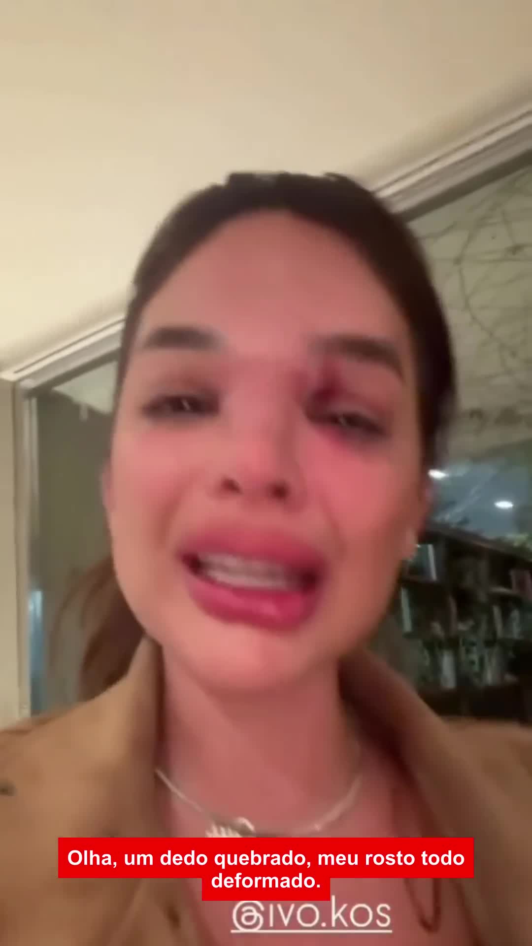 Mulher mostra ferimentos no rosto enquanto relata violência doméstica em vídeo